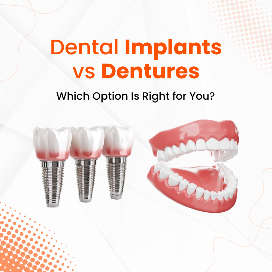Dental Implants vs Dentures