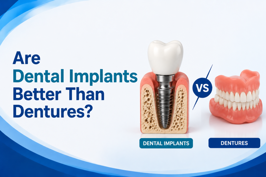 Are Dental Implants Better Than Dentures