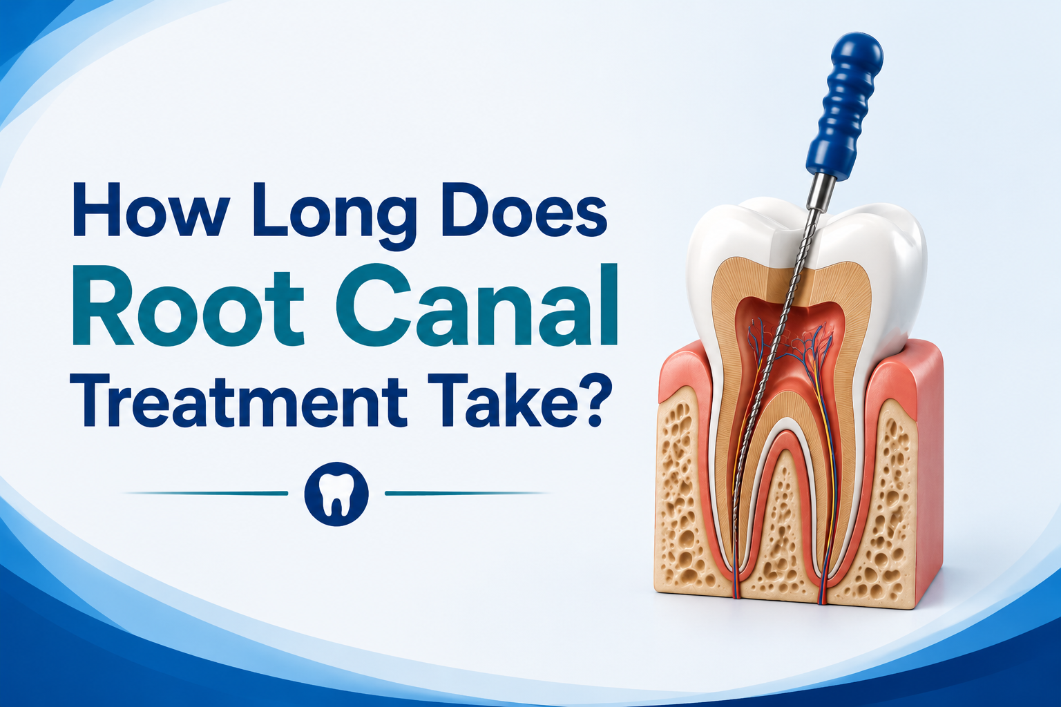 How Long Does Root Canal Treatment Take